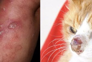 Médicos veterinários de Mariana Pimentel explicam sobre os meios de contato e medidas preventivas contra a esporotricose