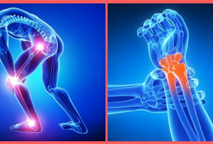Como Reduzir as Dores Articulares Naturalmente