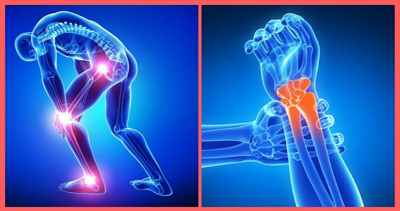 Como Reduzir as Dores Articulares Naturalmente