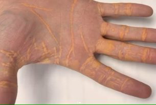 Um homem de 40 anos queria emagrecer e ter mais disposição.